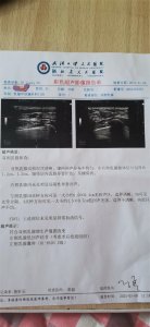 ​乳腺纤维瘤能怀孕吗 乳腺纤维瘤能怀孕吗